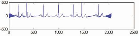 using the FFT method of eliminating 50Hz interference of the ECG signal